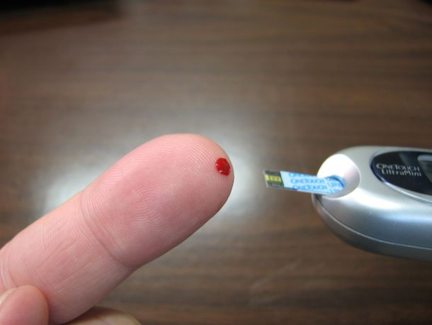 Pflege bei Diabetes